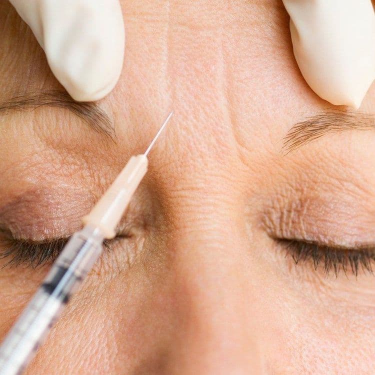 Injections – Fillers