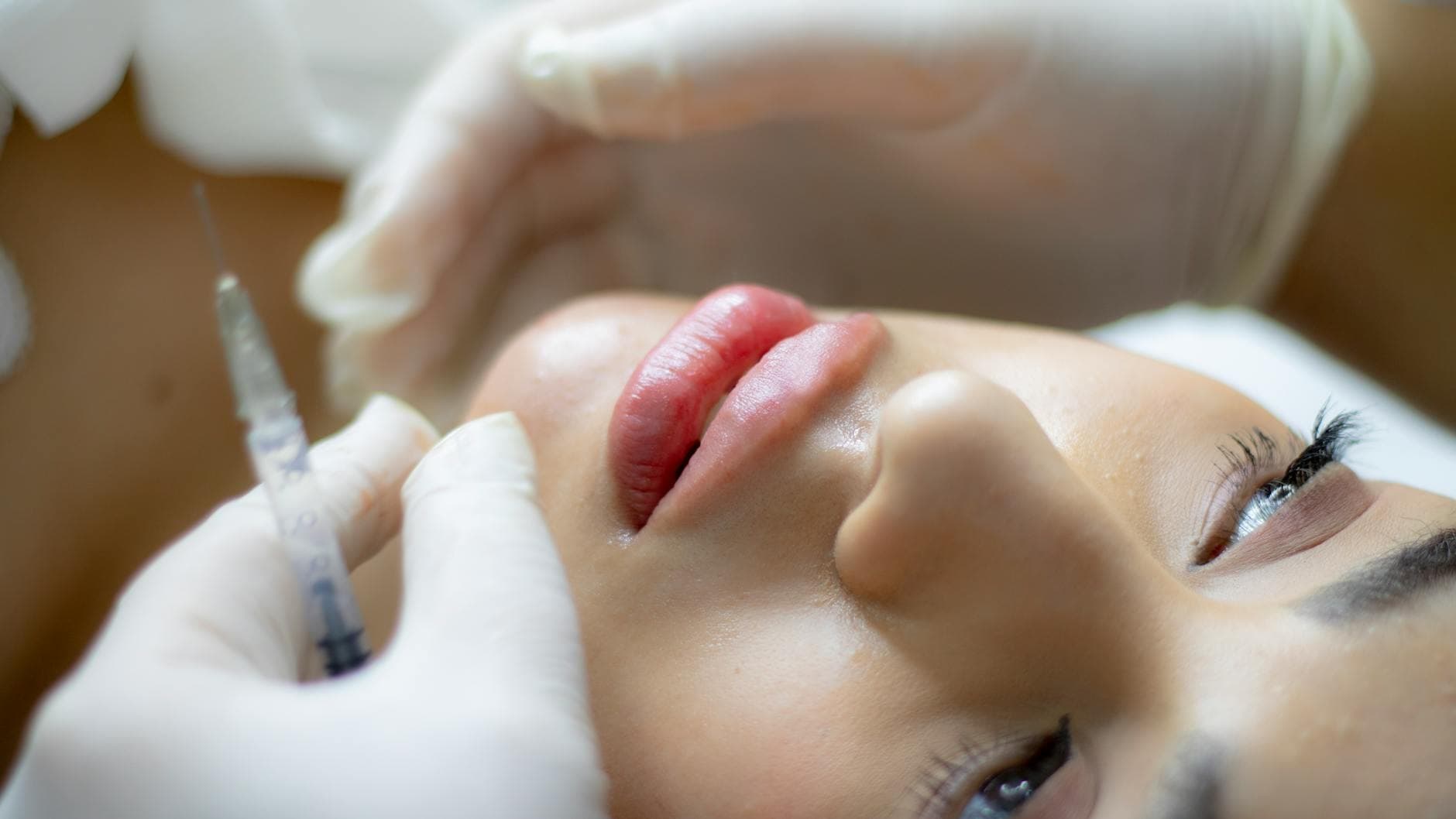 Injections fillers